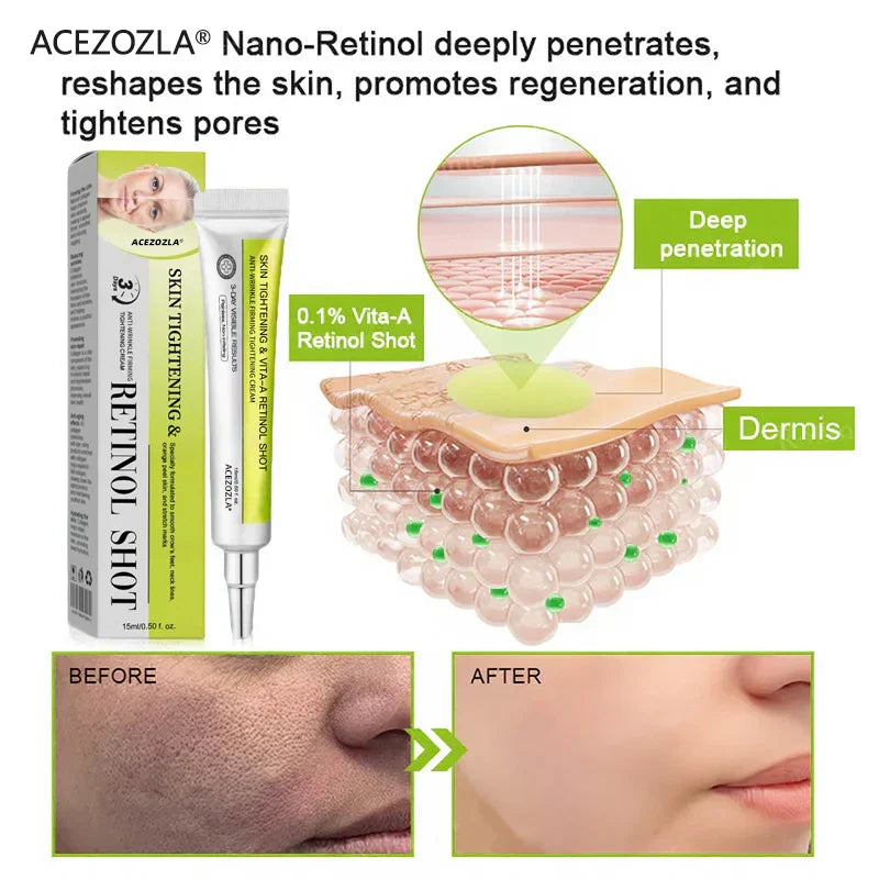 Collagen Collapse Repair: At-Home Retinol Peptide Cream to Lift Sagging & Smooth Wrinkles