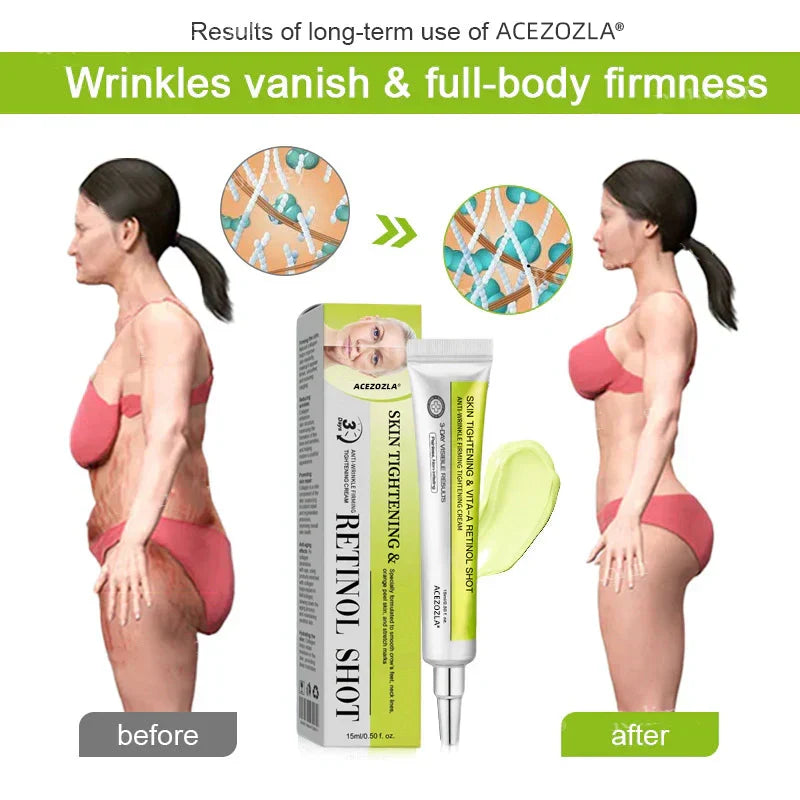 Collagen Collapse Repair: At-Home Retinol Peptide Cream to Lift Sagging & Smooth Wrinkles