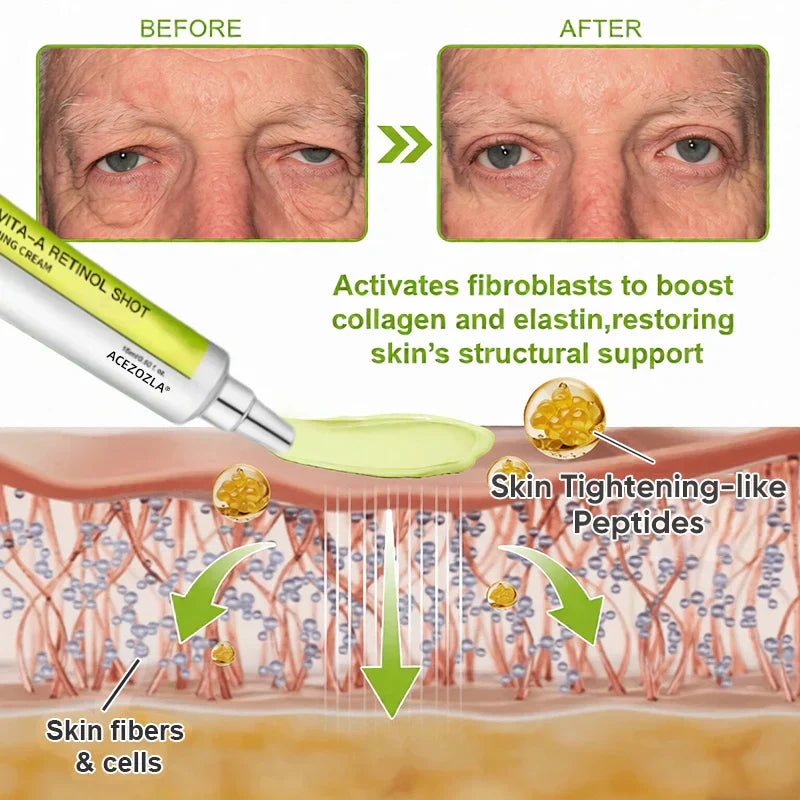 Collagen Collapse Repair: At-Home Retinol Peptide Cream to Lift Sagging & Smooth Wrinkles